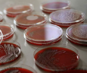 FoodSphere technology fighting off bacteria, such as E-Coli