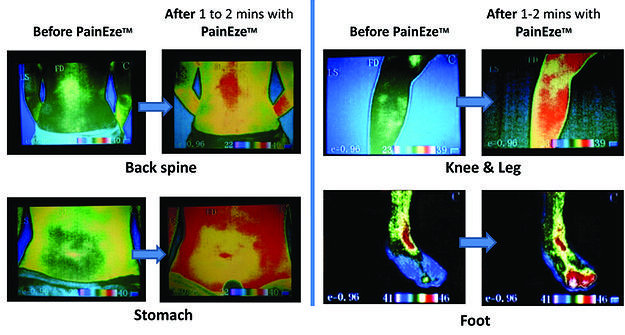 Infrared images of Back Spine, Stomach, Foot, and Knee and Leg areas before and after PainEze - Esmo Technologies